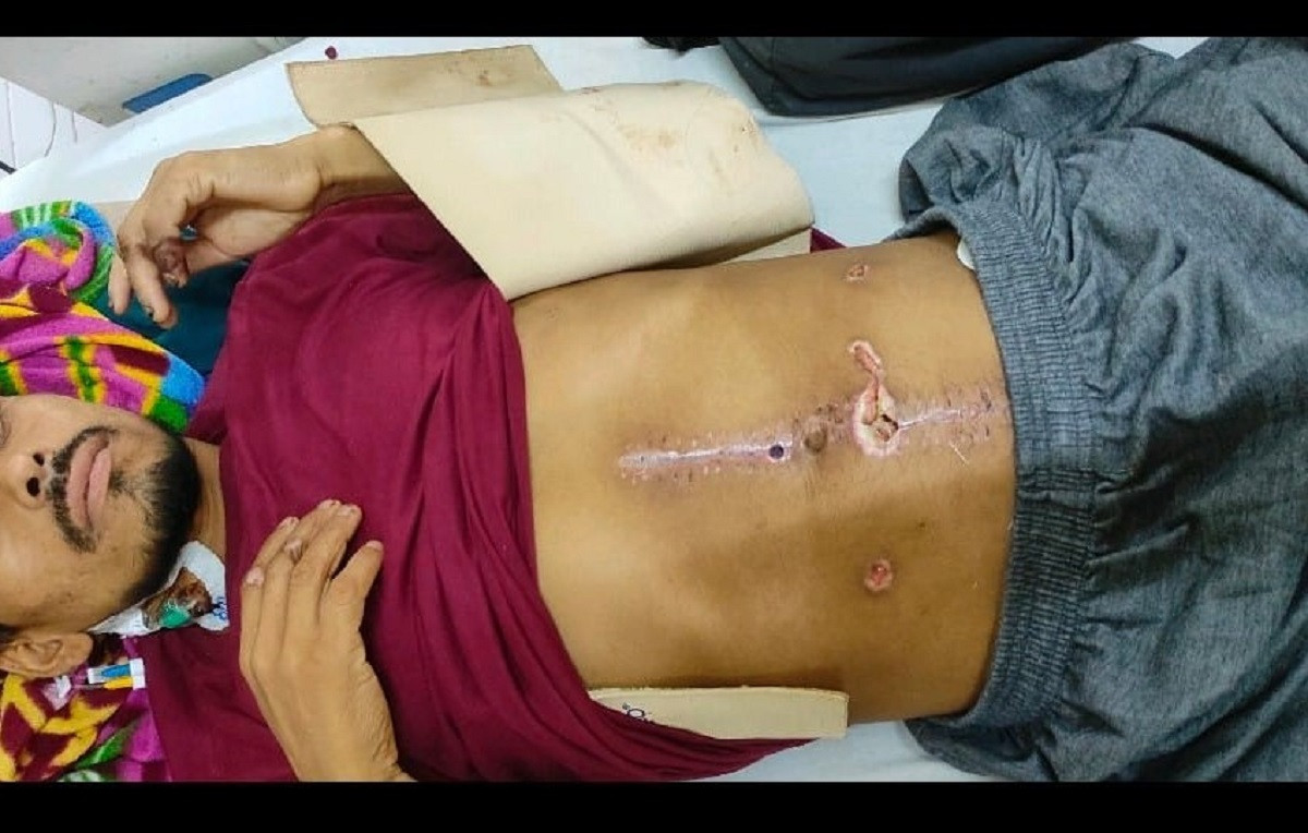 श्रीमतीलाई खुकुरी प्रहार गर्दा घाइते बनेका श्रीमान प्रहरी नियन्त्रणमा