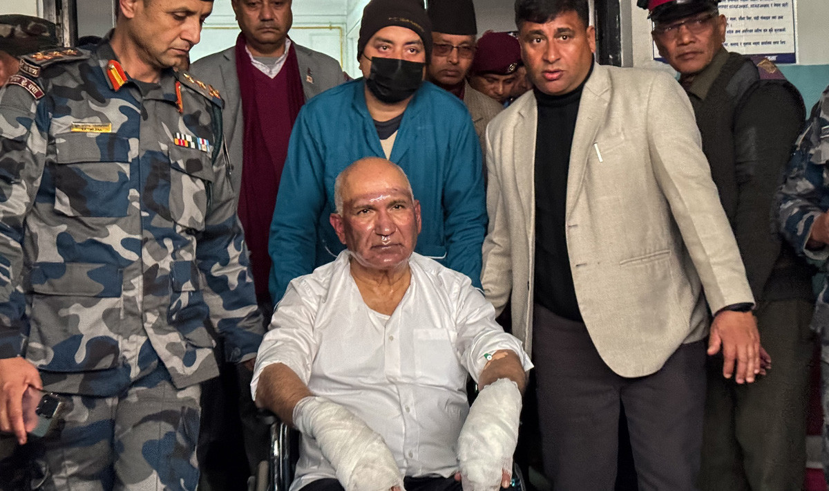 उपप्रधानमन्त्री पौडेल र मेयर आचार्यको अवस्थामा सुधार, भेटघाट निषेध
