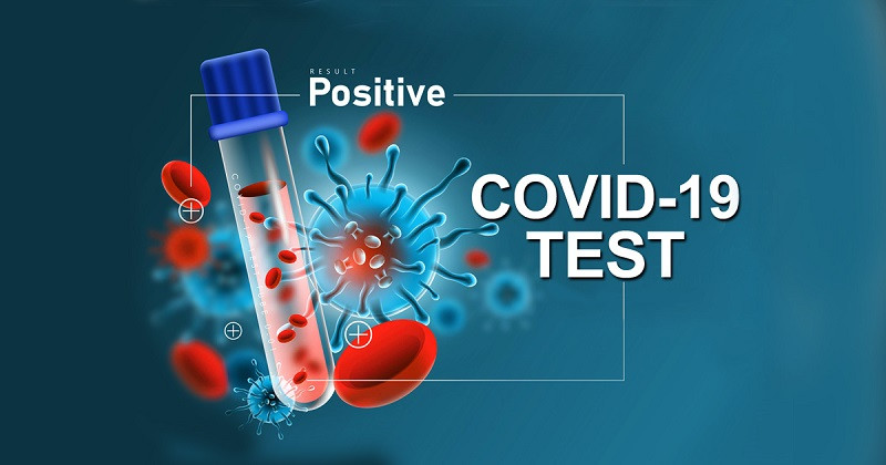 ७ दिनमा ३० जनामा कोरोना सङ्क्रमण पुष्टि, बिरामीको सङ्ख्या थपिँदै