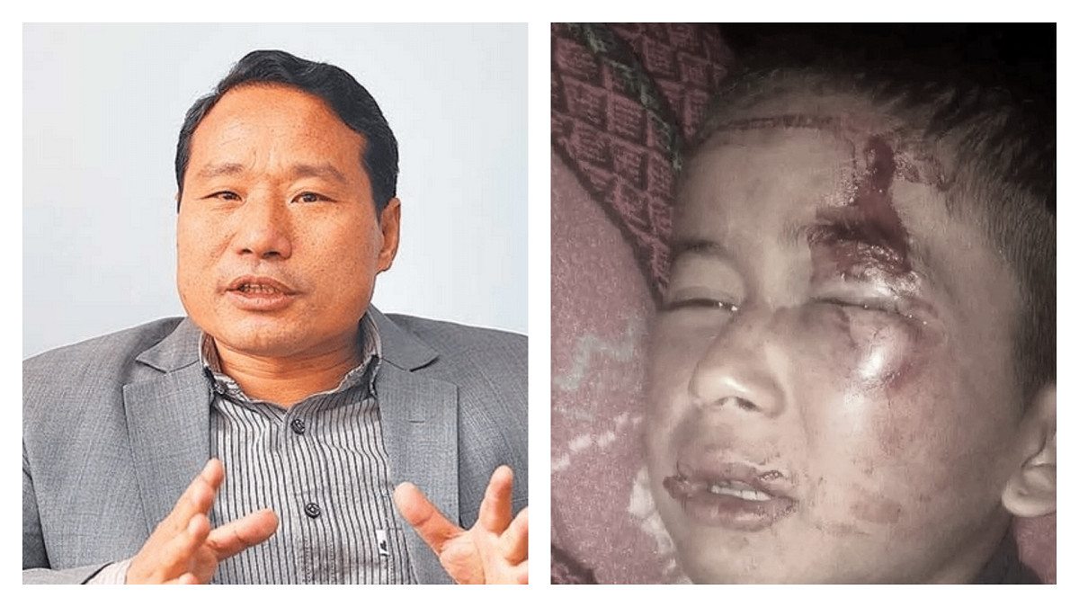 रोल्पा घटनाका दोषीलाई कारबाही गर्न वर्षमान पुनको माग